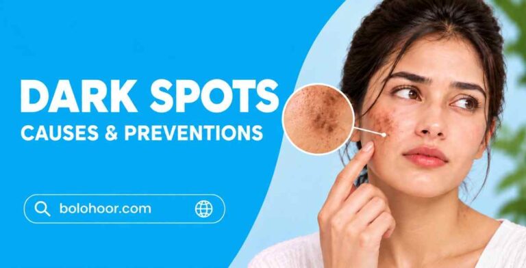 Dark Spots On Face