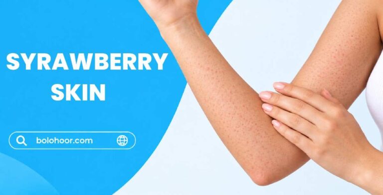 Strawberry Skin