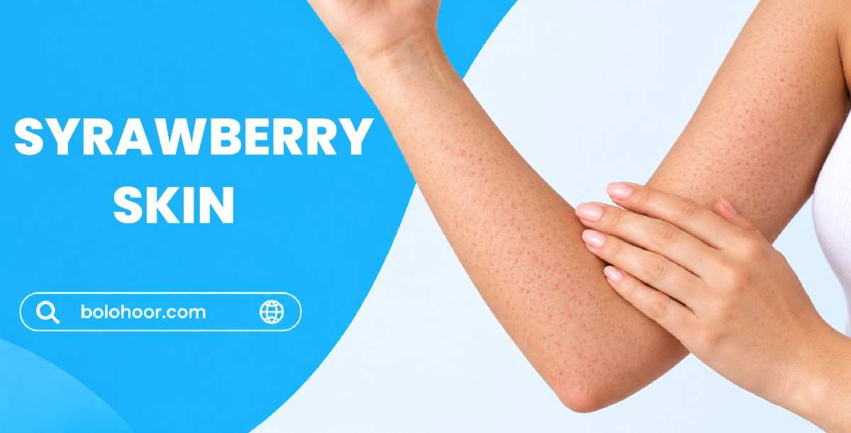 Strawberry Skin